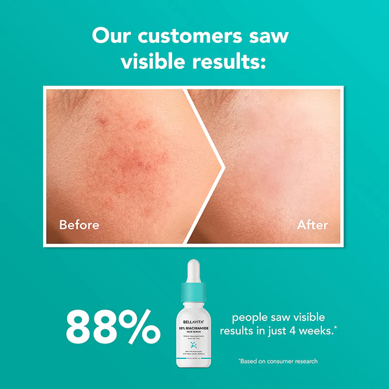 10% Niacinamide Face Serum - 10ml - Image 4