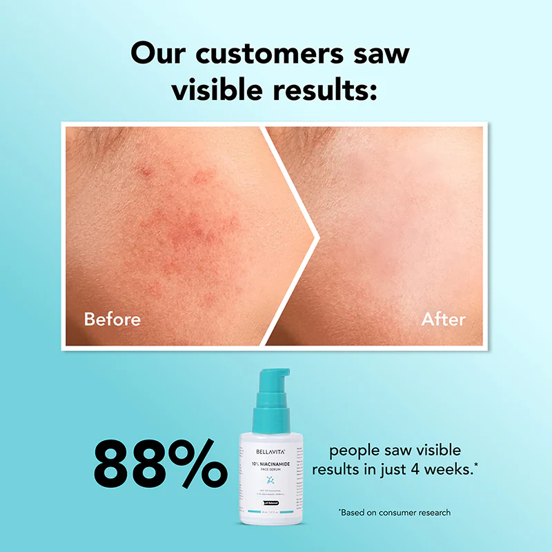 10% Niacinamide Face Serum - 30ml - Image 4