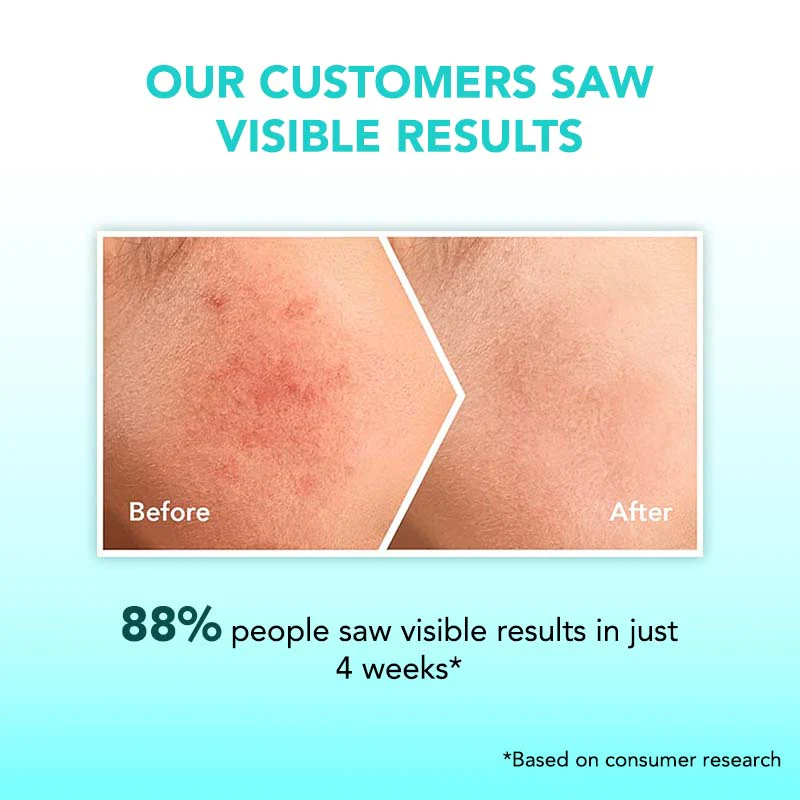 Anti-Pigmentation & Glow Kit - Image 5