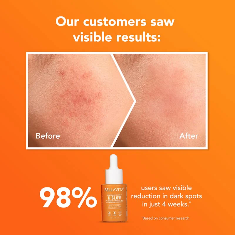 C-Glow 10% Vitamin C Serum - 30ml (Pack of 2) - Image 4