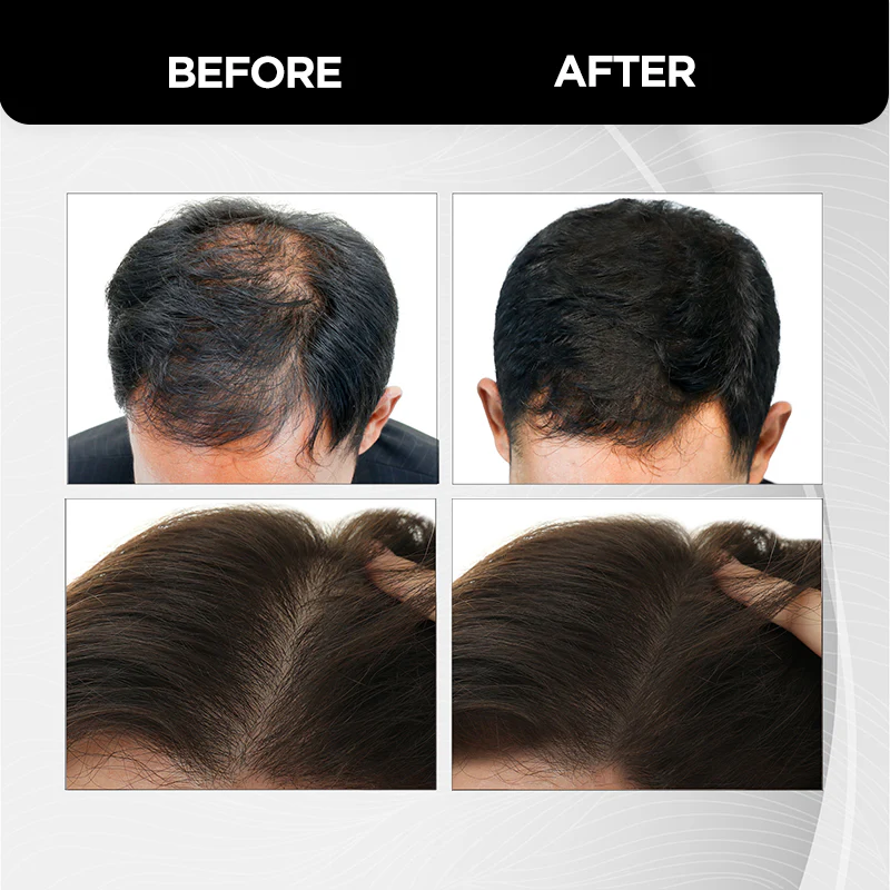 Hair Building Fibers - 12g - Image 7